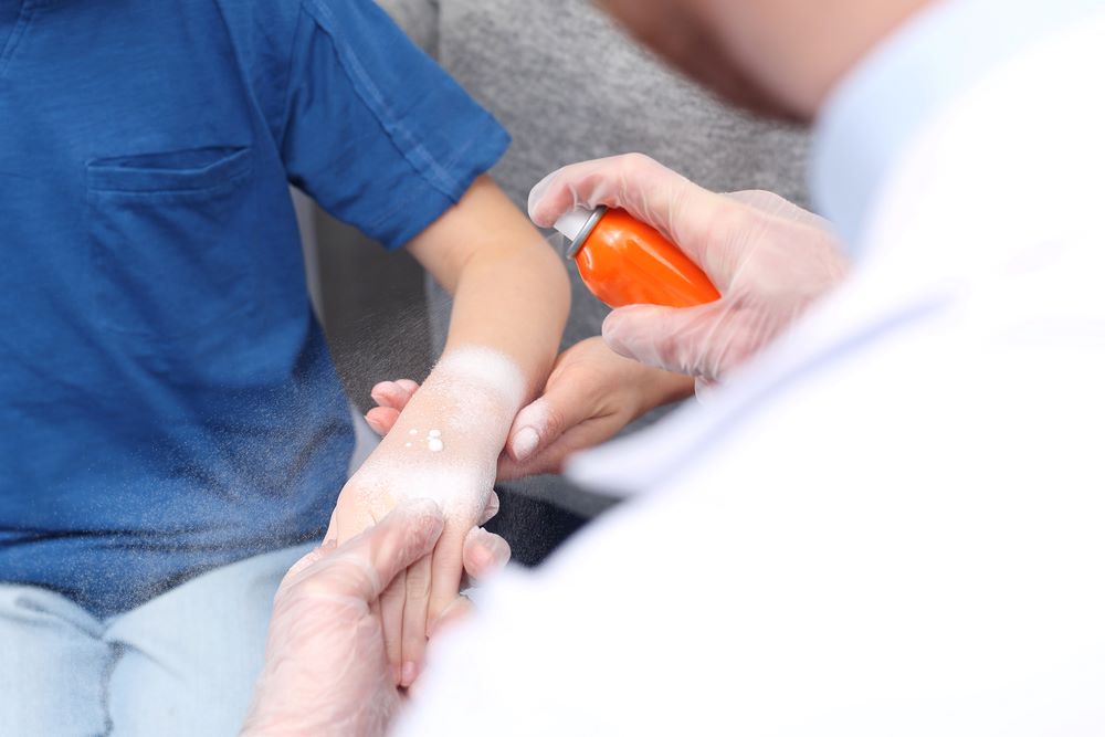 What Are Burn Injuries Image of a doctor applying soothing foam dressing as first aid for burns on a child, featuring 411 Personal Injury Law and highlighting 'What Are Burn Injuries?', ensuring it aligns with the page's context.